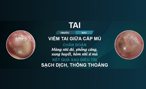 taimuihong5.jpg